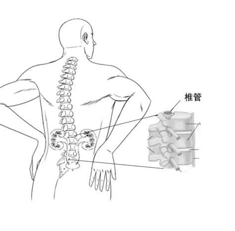 肾疼和腰疼的区别图
