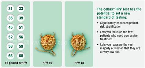 外阴hpv18