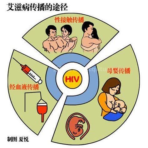 艾滋病感染5个条件