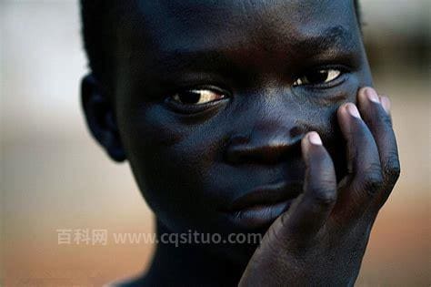 非洲人的皮肤为什么那么黑？