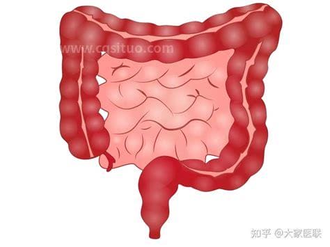 为什么直肠癌术后千万别化疗