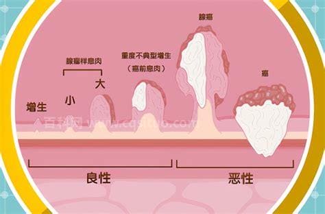 请问癌胚抗原的正常值范围是多少？