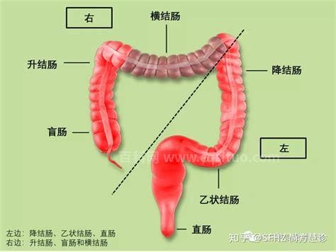 直肠癌一二三四期症状？