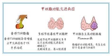 graves病是什么病的简称