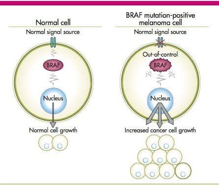 Braf基因突变是什么意思