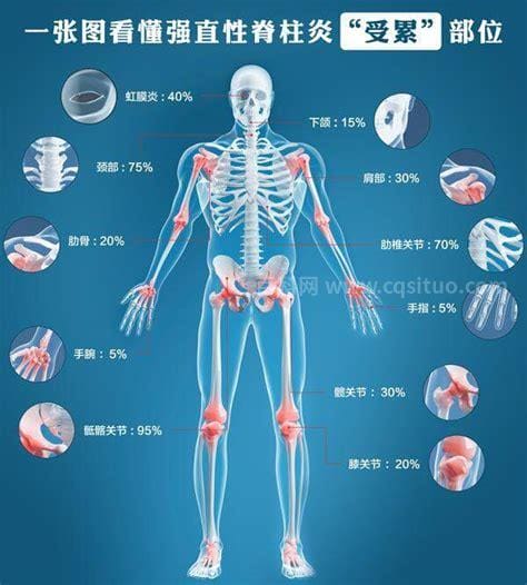 周杰伦的强直性脊椎炎病能活多久？