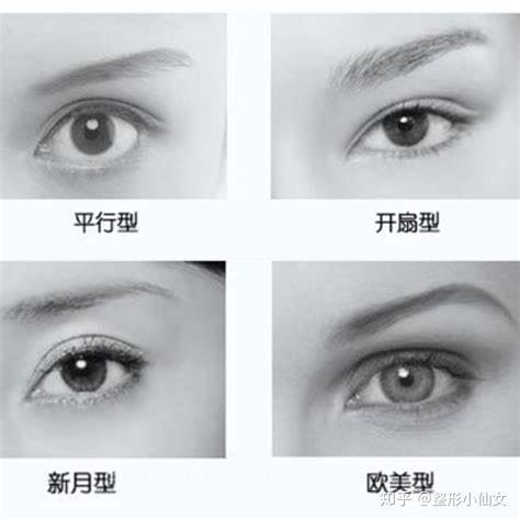 4种双眼皮类型图片
