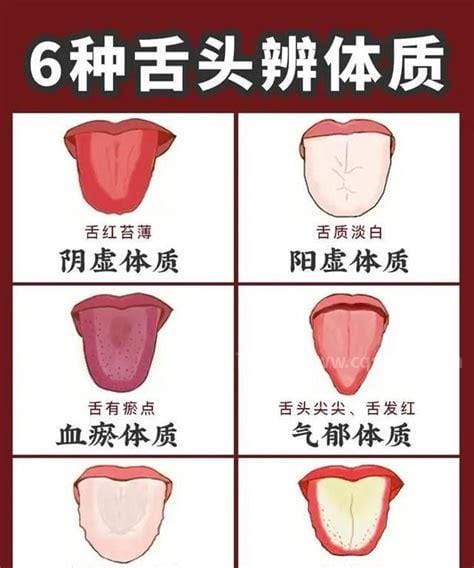 教你怎样看舌头诊断疾病