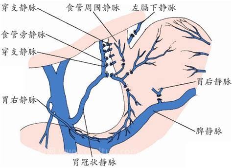 什么是门脉高压？