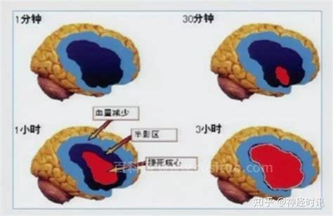 成人缺氧缺血性脑病的原因是什么