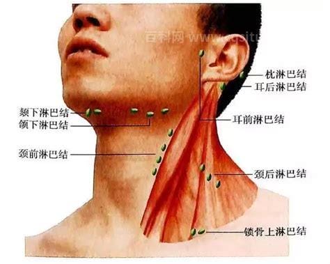 慢性淋巴结炎多年不消