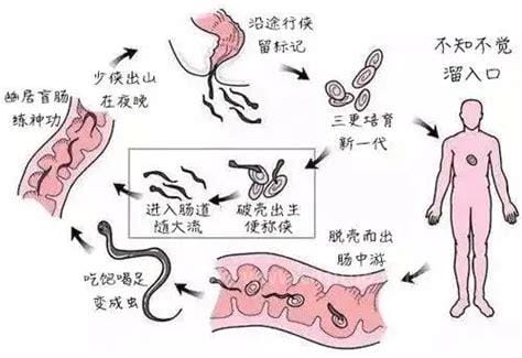 蛲虫病的治疗