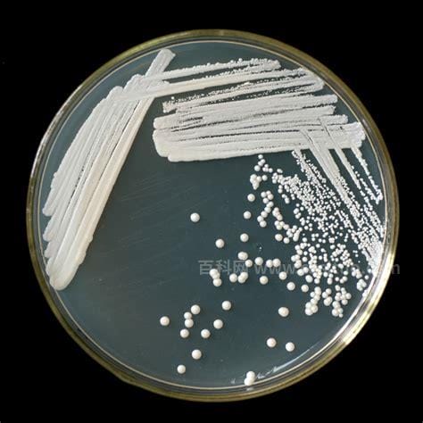 酵母菌的培养条件