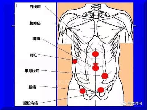 腹股沟位置在哪里