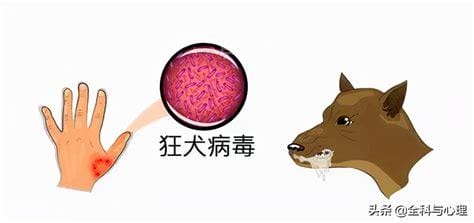 狂犬疫苗最佳时间是多少小时内