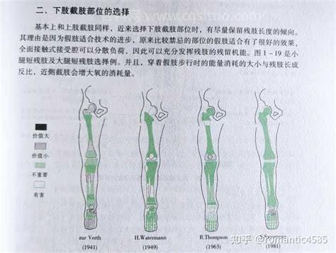 一只腿高位截肢算几级伤残