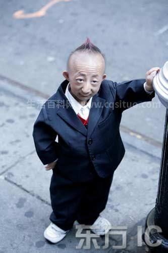 世界上最小的人，钱德拉·巴哈杜尔·