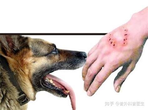 被猫抓出血了要打狂犬疫苗吗，建议注