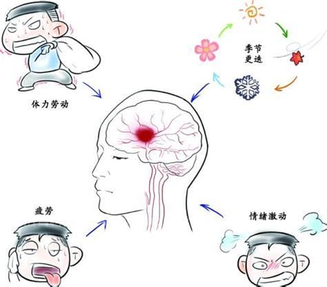 脑出血前有8个征兆，会出现视物旋转