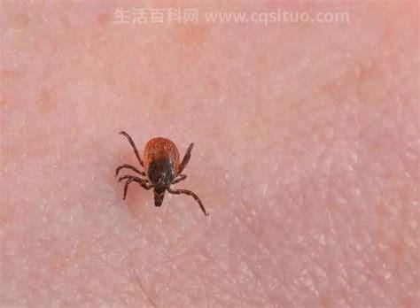 被蜱虫咬了一定会死吗？蜱虫咬死人是真的吗