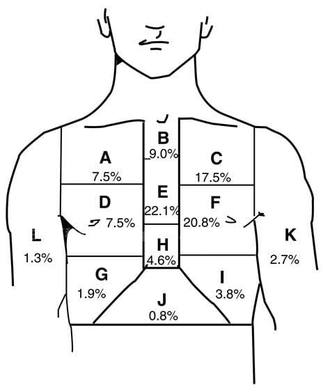 胸口疼痛部位对照表图解大全，帮你解读疼痛发生原因优质