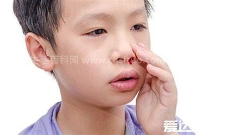 导致小孩鼻子出血的七种原因，不妨了解下