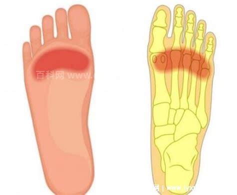 脚底疼痛部位图解，五个部位疼痛的病因（热水泡脚缓解最有效）