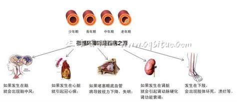 三种人血糖高不一定是糖尿病,非空腹／其他疾病／药物引起