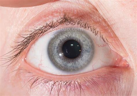 正常瞳孔和瞳孔放大图，瞳孔放大后超过两个小时会导致脑死亡优质