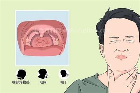 咽炎最怕的三种水果，分别是火龙果/