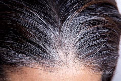 三个部位长白发最危险，分别是前额/两鬓/后脑勺优质