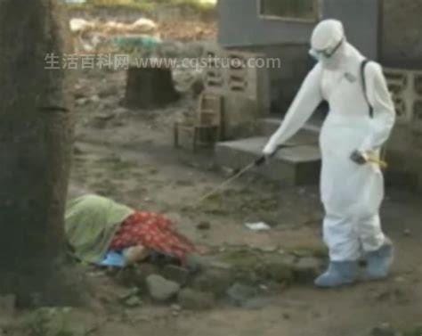 埃博拉患者真实照片，感染后流血而死优质