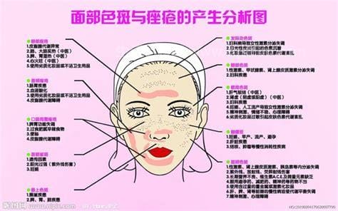 女人长斑的位置图解，前额两边和太阳穴（化妆残留可致眼尾长斑）优质