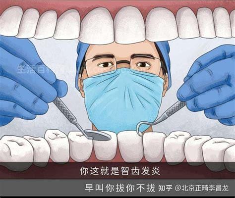 为什么牙医建议尽量不拔智齿，容易引