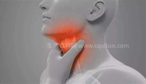 喉咙有异物感是什么病的前兆，小心食管癌/甲状腺疾病4种疾病优质