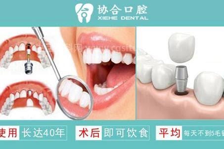 千万不要种植牙，有各种口腔炎症5种人不适合优质