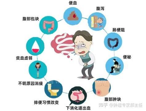 什么人容易得结肠癌，饮食结构不合理的人和中老年人优质