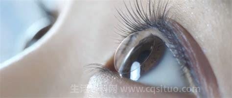 角膜塑形镜害了多少人，一不小心就容易导致眼睛红肿流泪等症状优质
