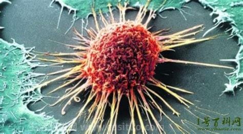恶化最快的三种瘤，包括胃癌、肺癌和乳腺癌3种优质