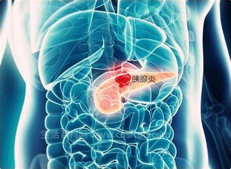 胰腺炎是哪个部位疼位置图片，在上腹