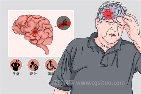 脑出血最常见的原因都有哪些
