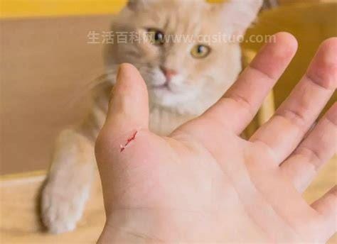 被猫抓伤出血要打针吗