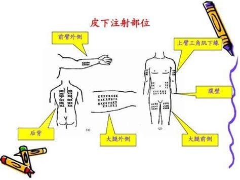 成人肌注的部位选择及定位方法