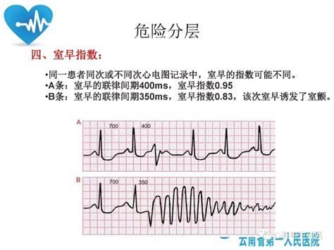 室性早搏的危害有哪些