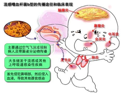 嗜血症是什么病