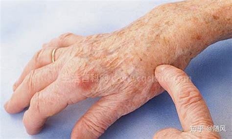 左手中指疼痛是什么原因