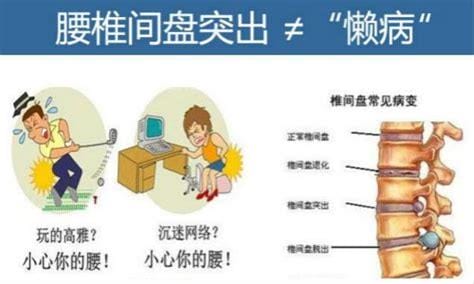 腰椎间盘突出最佳疗法是什么,治疗腰椎间盘突出最好的方法是什么药