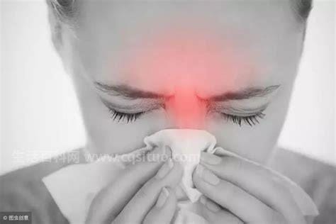 怎么治疗过敏性鼻炎,过敏性鼻炎的实用治疗偏方有哪些