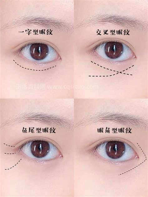 眼角纹怎么消除简单方法,眼部细纹