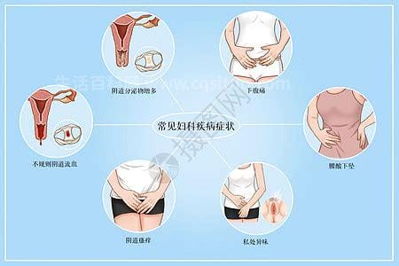 常见的妇科病有哪些